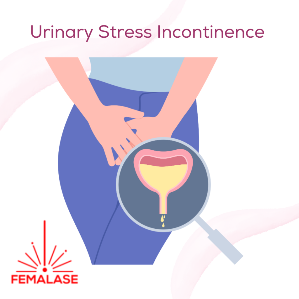 Urinary Stress Incontinence